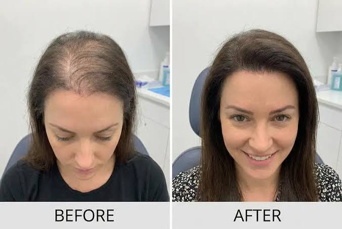 best oil for hair fall control and hair growth