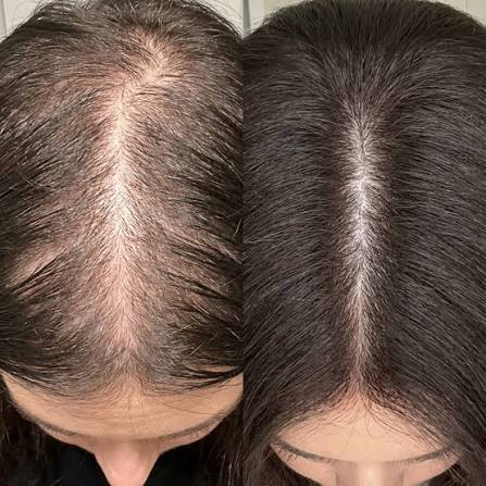 best oil for hair fall control and hair growth